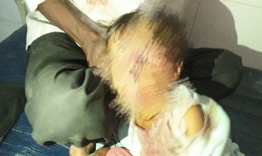 हिंस्र पशुचा लहान बालकांवर हमला