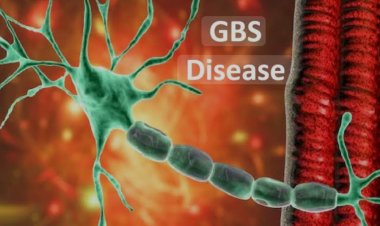 सावधान! सावधान! सावधान....  संभाजीनगरमध्ये जीबीएस चा प्रवेश